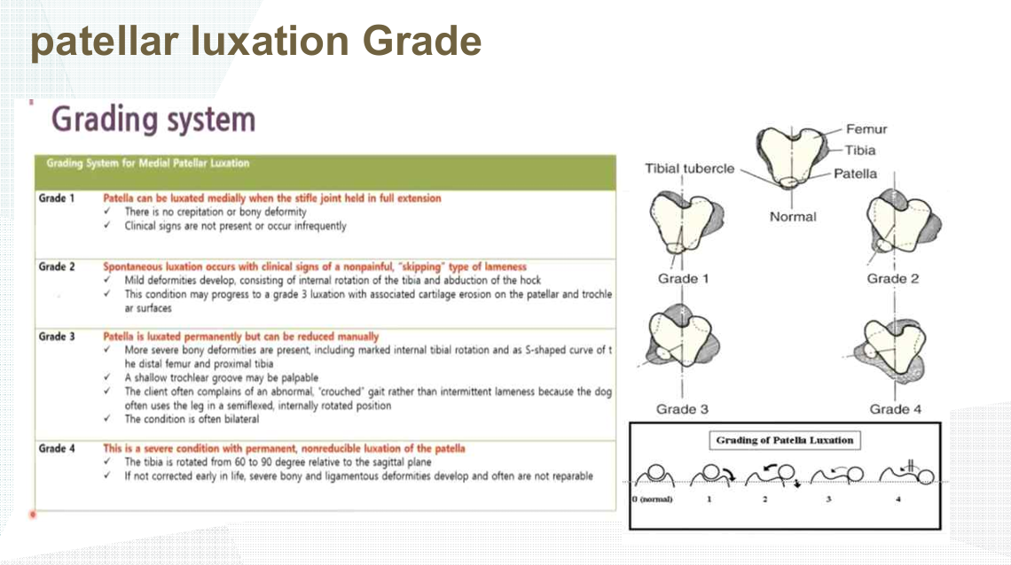슬개골 탈구 Grade 1~4 분류표 Grading System