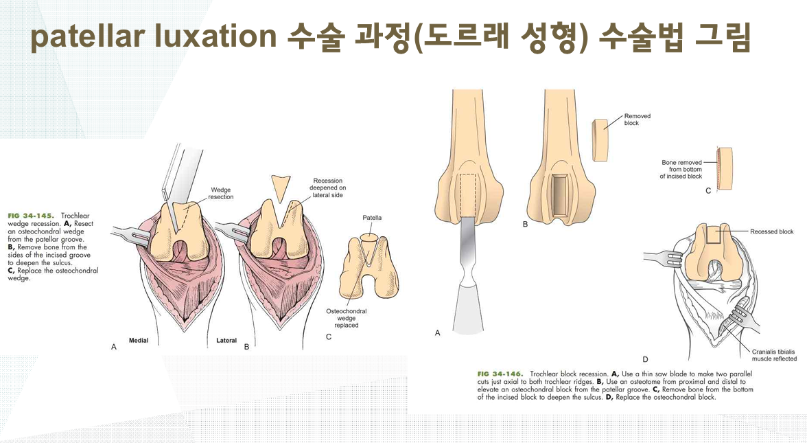 슬개골 탈구 도르래 성형 수술 과정 그림 Trochlear Resection